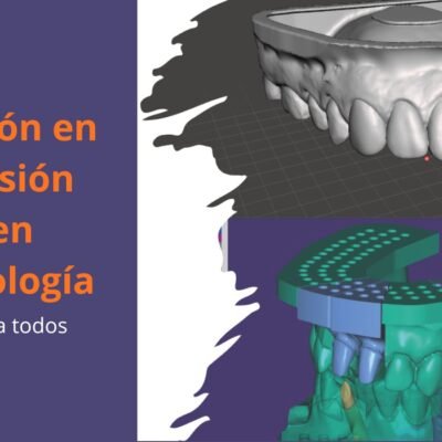 Iniciación en impresión 3D en Odontología